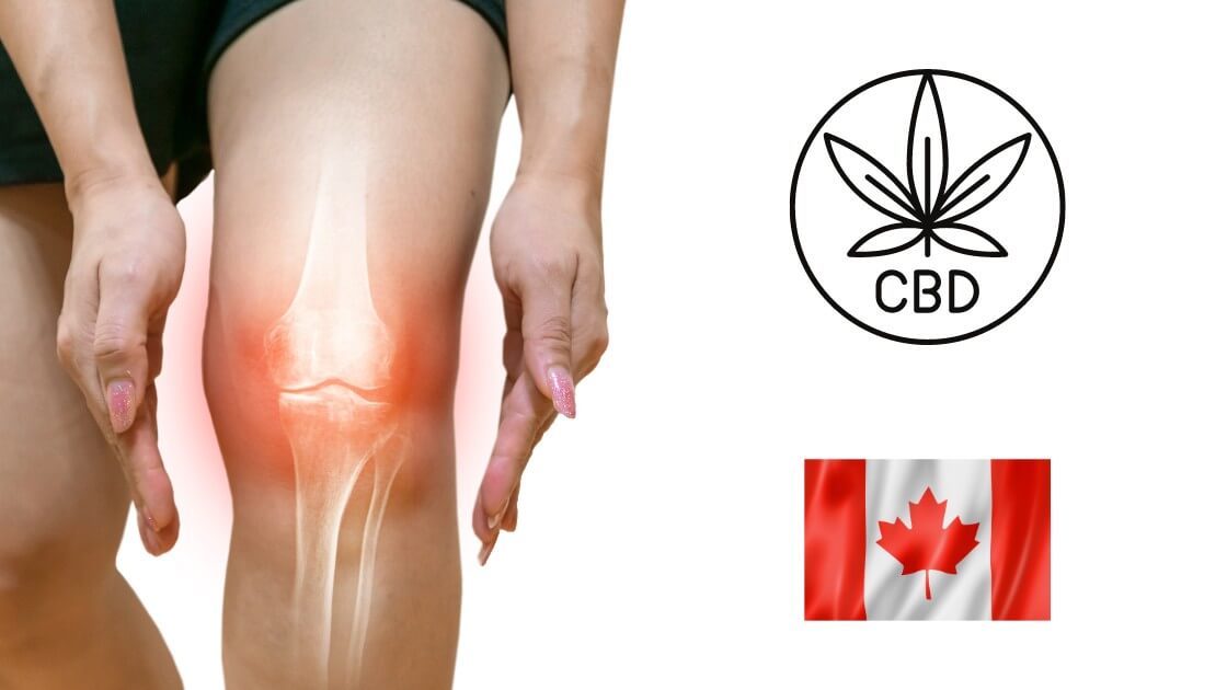 achat-cbd-arthrose (1)